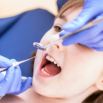 Estrazioni dentali nei bambini